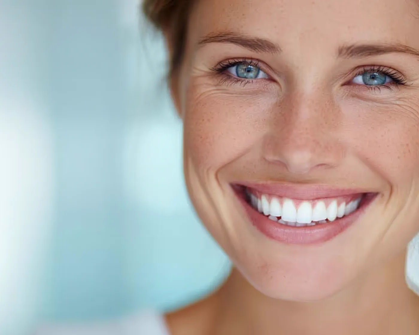 Sourire éclatant aux dents blanches après un blanchiment à Anderlecht